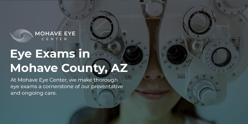 Eye Exams In Kingman Bullhead City Az Mohave Eye Center