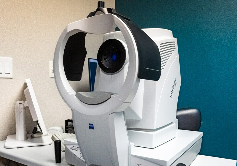 Glaucoma Diagnosis & Technology at Mohave Eye Center in Kingman, AZ
